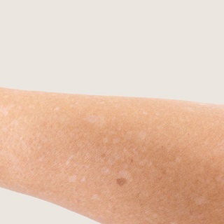 Spots